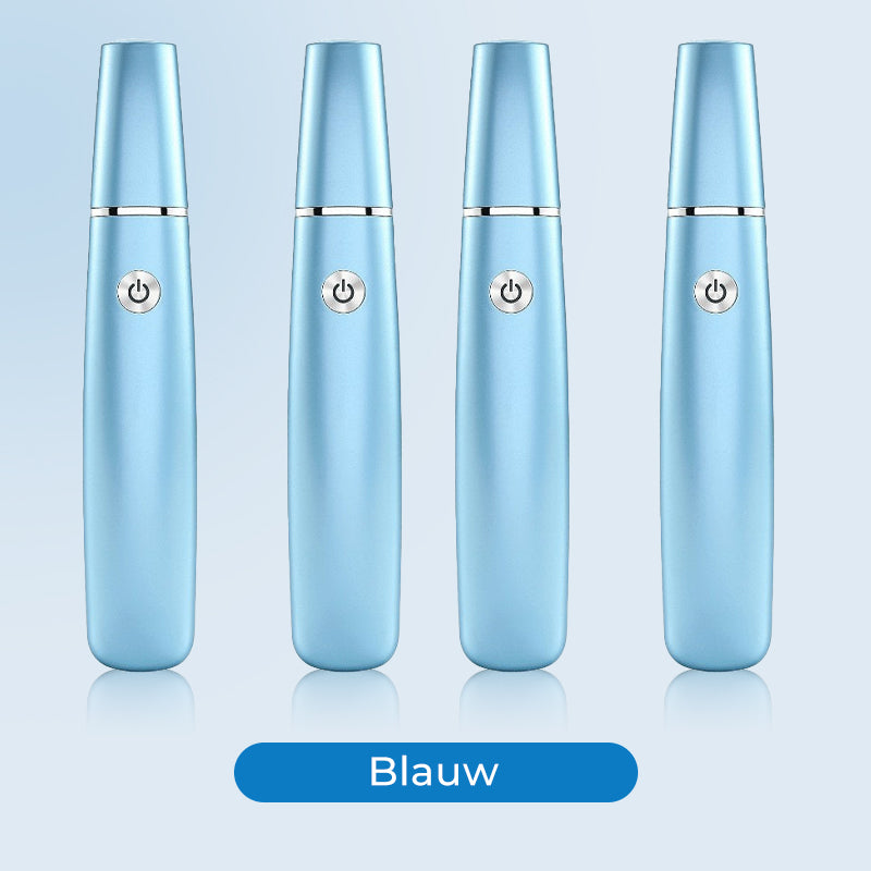 💕Moederdag Hete Uitverkoop 50%🔥Elektrische Voeten Eeltverwijderaar