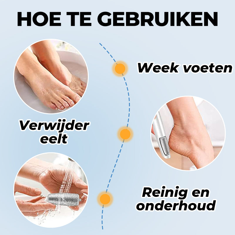 💕Moederdag Hete Uitverkoop 50%🔥Elektrische Voeten Eeltverwijderaar