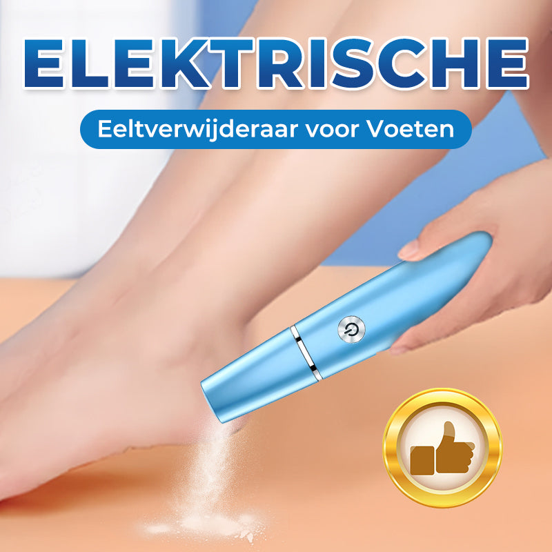 💕Moederdag Hete Uitverkoop 50%🔥Elektrische Voeten Eeltverwijderaar