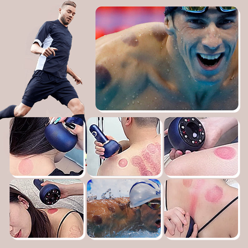 Set met elektrische cupping-massageapparaat en meridiaanborstels
