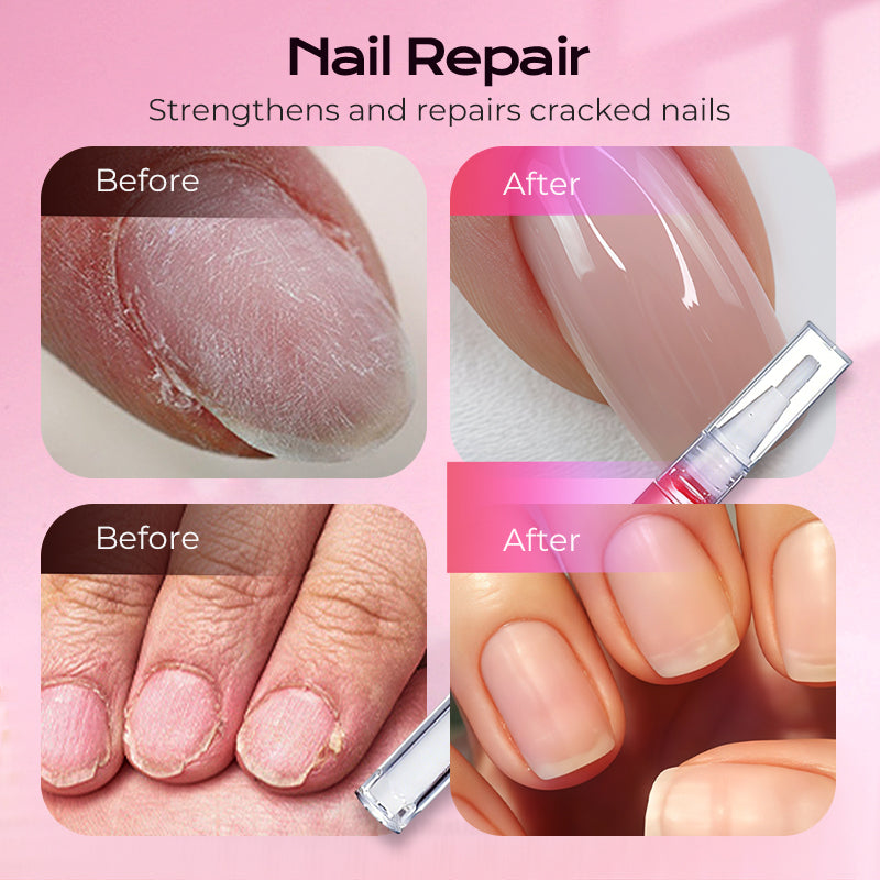 💅 Natuurlijke Nagelriem Olie-Pen – 50% KORTING! 🌿 Verzorgd & versterkt droge nagelriemen – met Jojoba & Amandelolie.✨