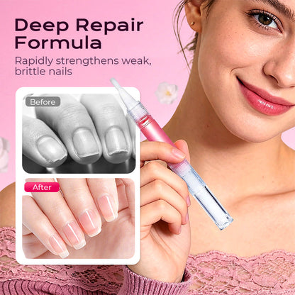 💅 Natuurlijke Nagelriem Olie-Pen – 50% KORTING! 🌿 Verzorgd & versterkt droge nagelriemen – met Jojoba & Amandelolie.✨